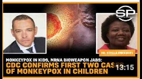"CDC Confirms First Two Cases of Monkeypox in Children Following mRNA Injections"