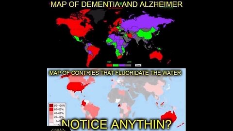 Fluoride Is Toxic And Is Only ONE Of The Causes Of Dementia & Alzheimer's! Michael Gibson