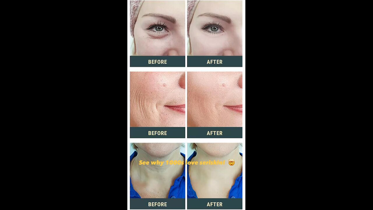 Feel than years younger with Research backed, seriskin infused with plump peptide! 😉❤️
