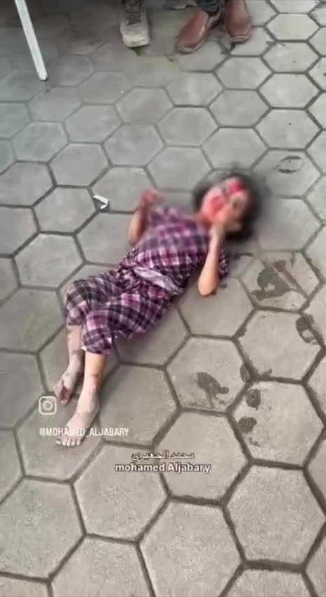 Children fall victim to unbearable wounds