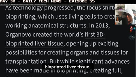 3d printing positively used for appendages and prosthetics