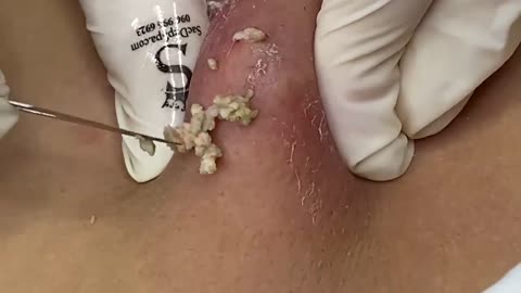 Relax Everyday With Beauty Spa Videos #03