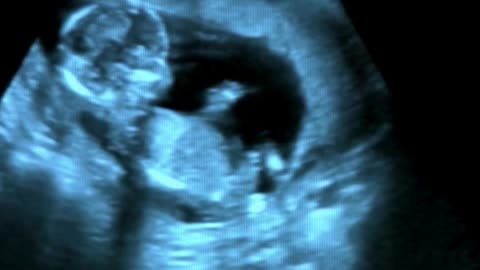 ICSI Expertise at Sumathi Hospital: personalized Solutions for Male‑Factor Infertility