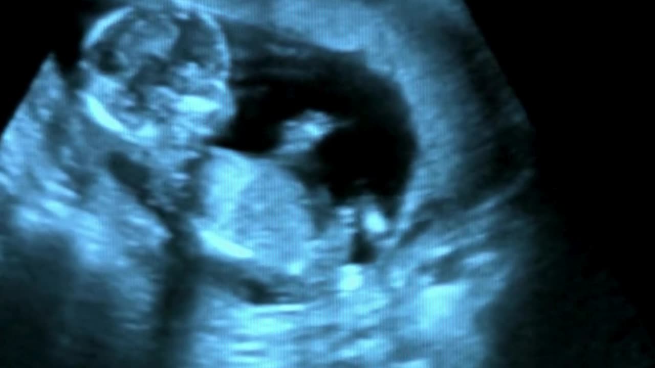 ICSI Expertise at Sumathi Hospital: personalized Solutions for Male‑Factor Infertility