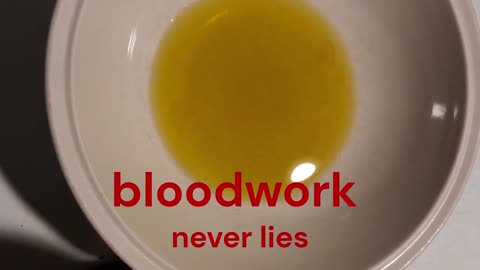 A S D-A Simple Diet
