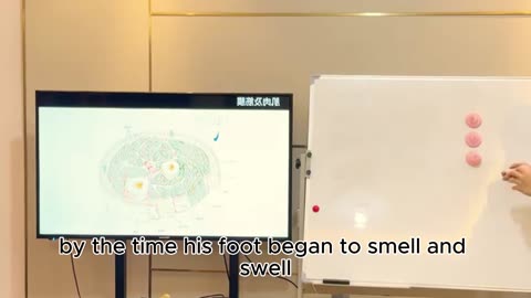 The Man Who Lost His Foot Because He Didn’t Know He Had Diabetes