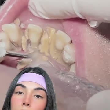 cuando crezca quiero ser una gran odontóloga como usted 🥺💗