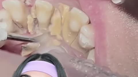 cuando crezca quiero ser una gran odontóloga como usted 🥺💗