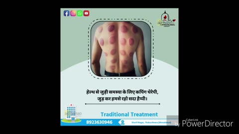 Knee Pain Treatment with Hijama Therapy | Cupping Therapy for Joint Pain Relief