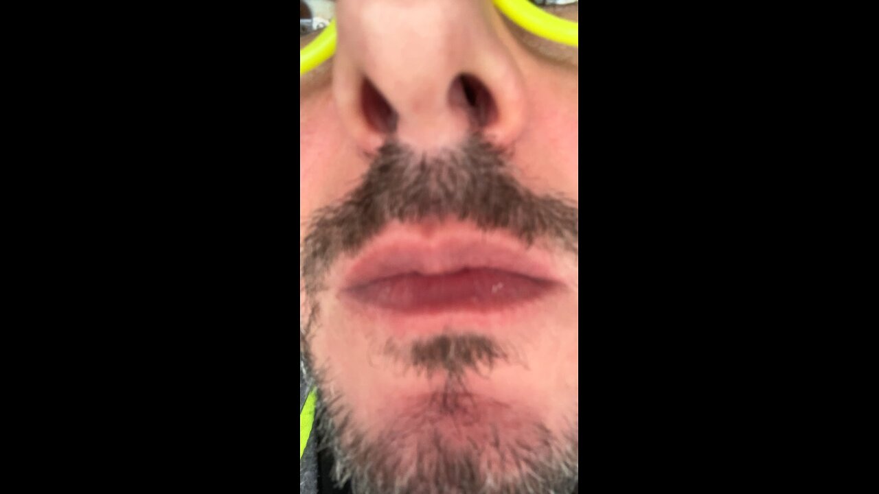 “When Your Finger Has a Mind of Its Own! | Italianinho Comedy”
