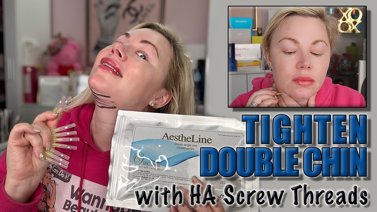 Tighten Double Chin with HA PDO Screw Threads, AceCosm.com and Code Jessica10 Saves Money