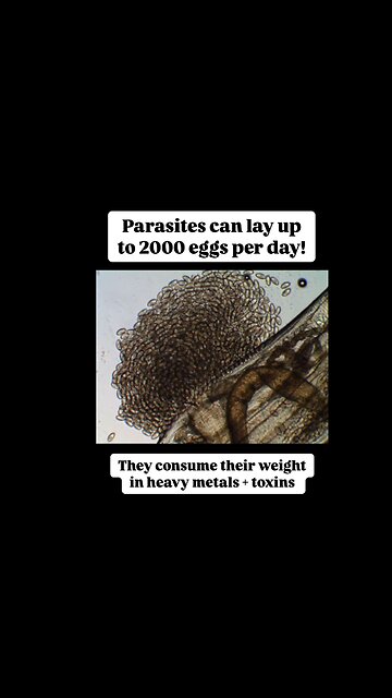 This is why they put metals in your body - protects the parasites