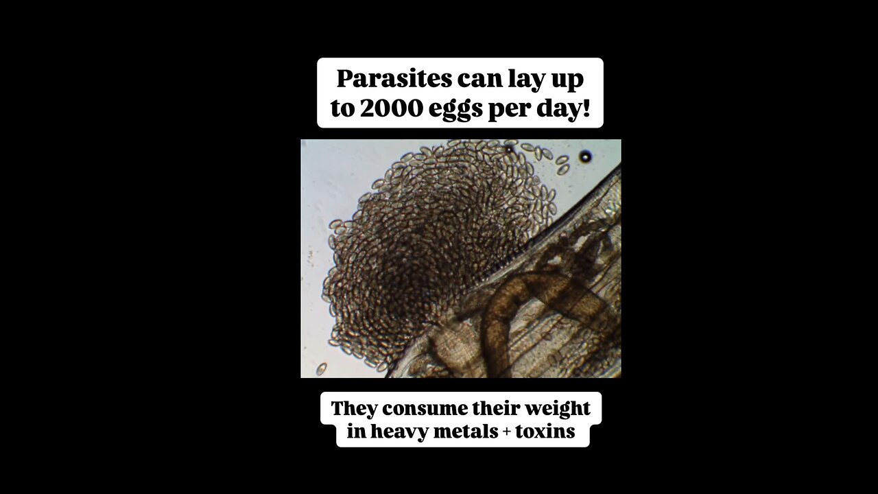 This is why they put metals in your body - protects the parasites