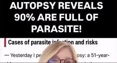Autopsies reveal 90% of the dead are full of parasites.