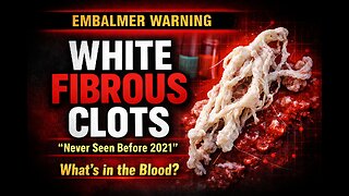 SHOCKING White Fibrous Clots in Vaxxed Bodies – Embalmer Exposes Truth!