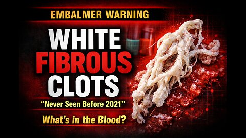 SHOCKING White Fibrous Clots in Vaxxed Bodies – Embalmer Exposes Truth!