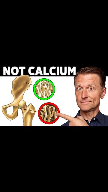 Health reform: Bones are not only made of calcium!