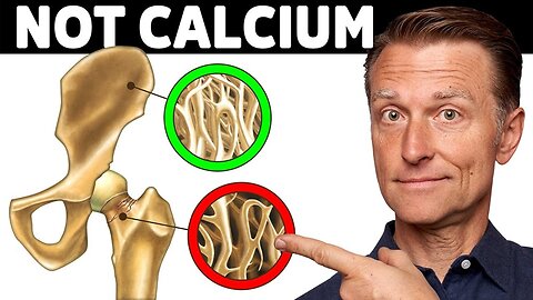 Health reform: Bones are not only made of calcium!