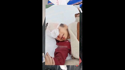 Only Survivor: Arkan Osama Assaf Seriously Wounded in Gaza Strike