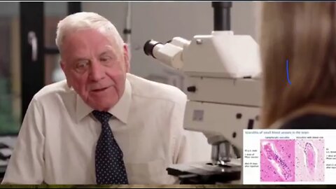 Professor Arne Burkardt: COVID-19 mRNA vaccines cause generalised vasculitis