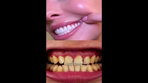 Try this natural teeth whitening remedy