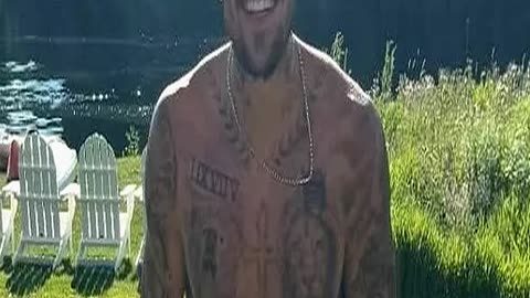 Justin Bieber Worries Fans as He Poses in Seethro