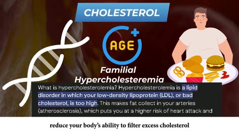 If You Have High Cholesterol, Start Taking These Supplements ASAP