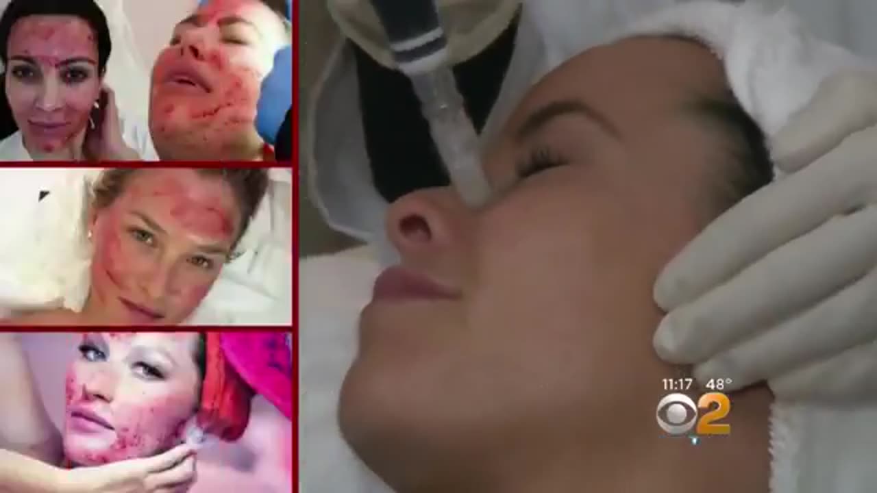 Ambrosia was Peter Thiel’s company…