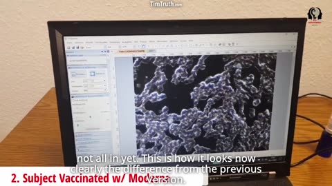 worms-hatching-from-eggs-researchers-present-strange-vax-microscopy-findings-amp-blood-comparison