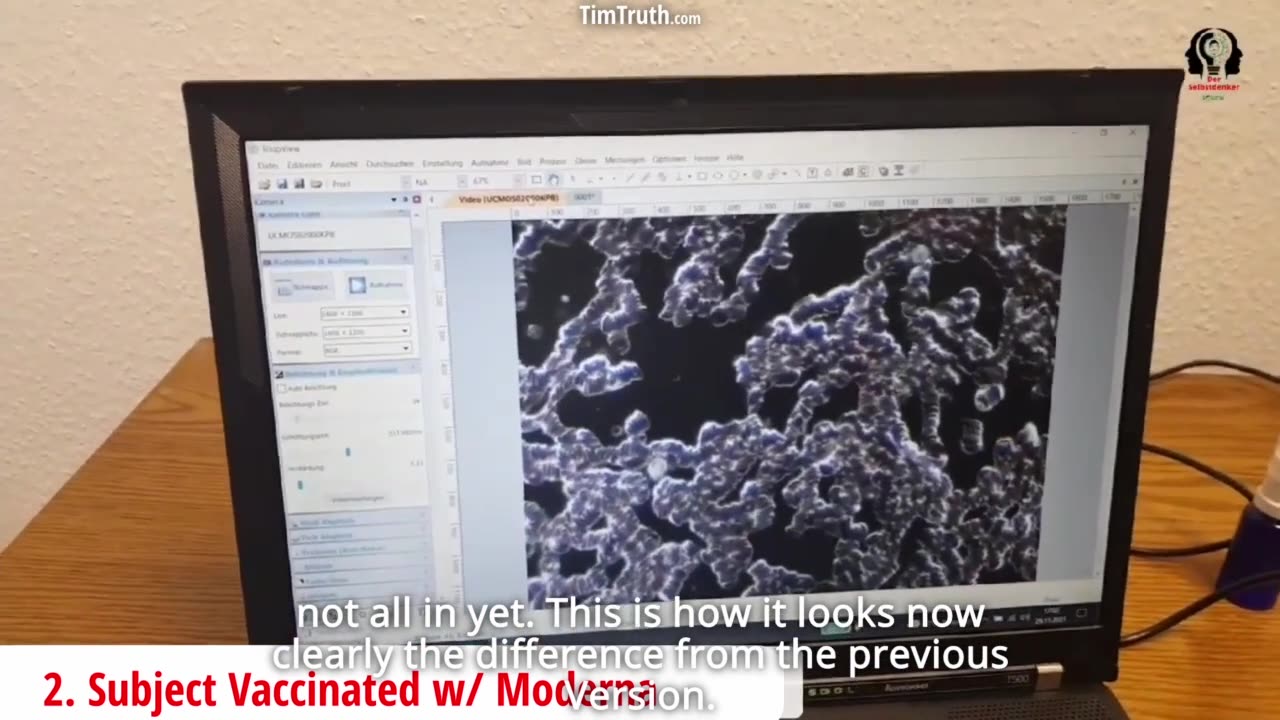 worms-hatching-from-eggs-researchers-present-strange-vax-microscopy-findings-amp-blood-comparison