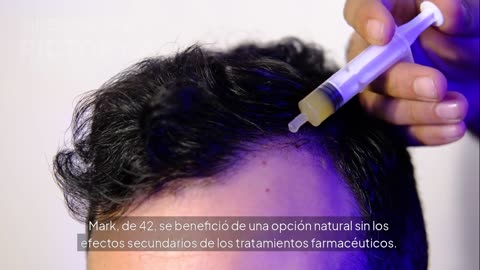 VERDEXEDIL DEEP DIVE: The Herbal Minoxidil Alternative That Reverses Gray Hair & Boosts Growth!