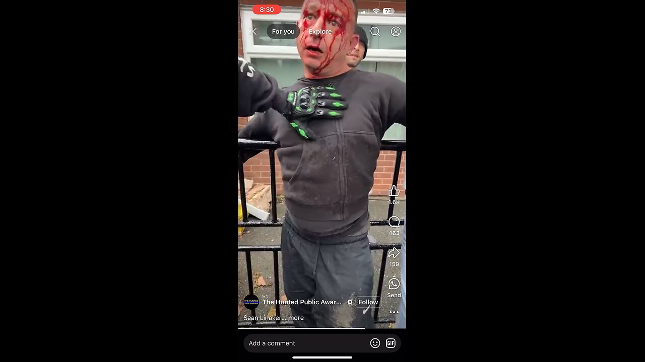 Nonce tries resisting and injures himself in the process - Sean Linaker