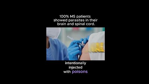 Parasites found in brain & spinal cord of 100% of MS patients ~ Dr Lee Merritt