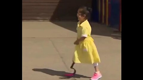 ❤️ Little Girl Reveals Her Prosthetic Leg to Friends - Their Reaction Is Pure Love