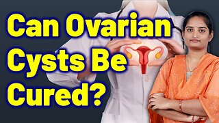 Best Treatment For Ovarian Cyst, Corpus Luteum Cyst, Abdominal Cyst. Homeopathy Medicine and Surgery