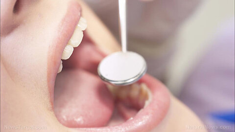 "Dangers of Root Canals and Mercury Fillings to Your Health"