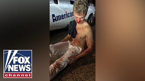 DETAILS: 'Big Balls,' ex-DOGE staffer, brutally attacked in DC