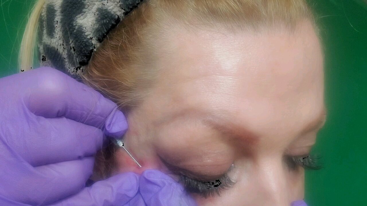 My DIY PCL Multi Threads for Under Eyes