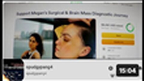 "Unmasking the Truth about Craniotomy Clot Shots and GoFraudMe Scams: Insider Analysis"