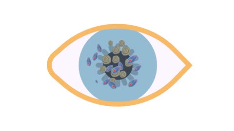 Eye Pain