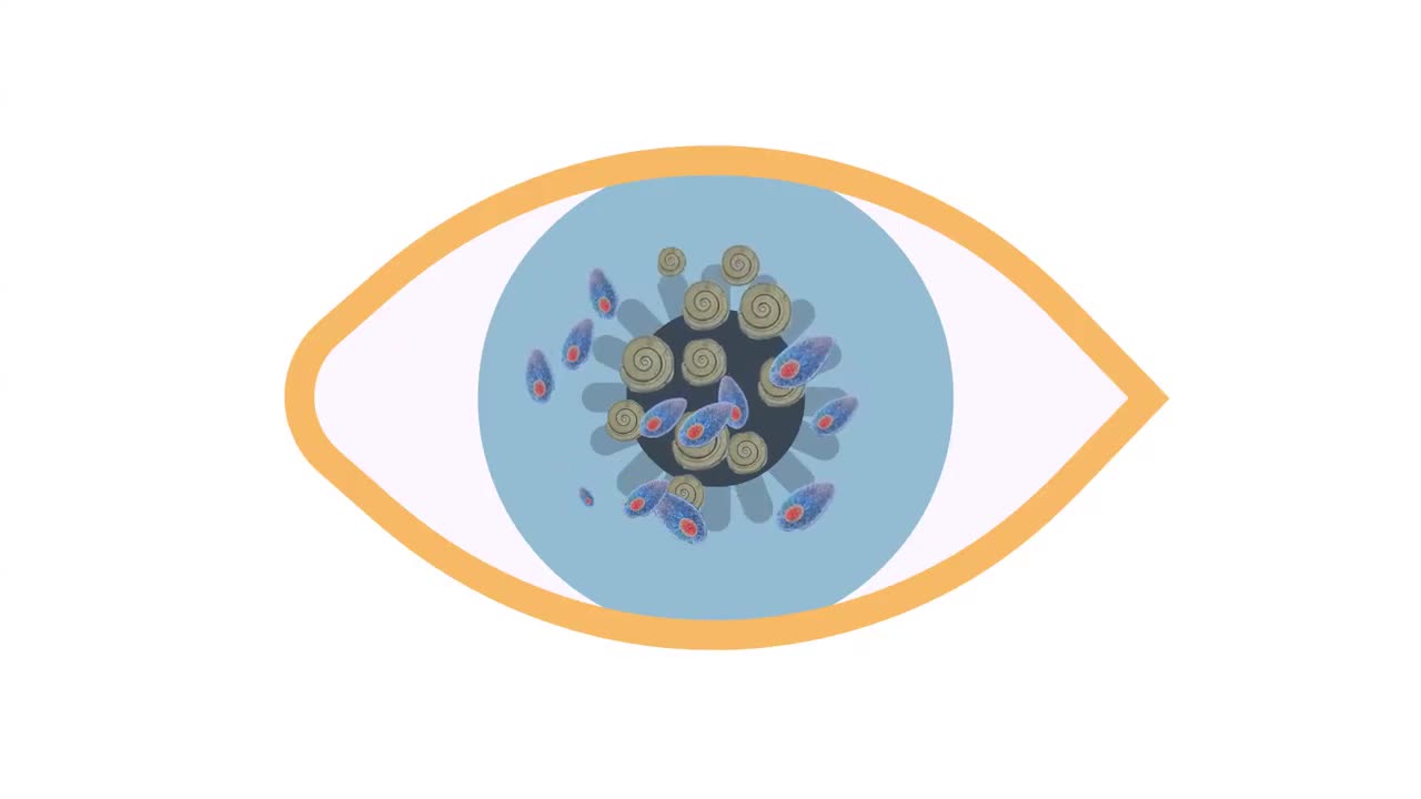 Eye Pain