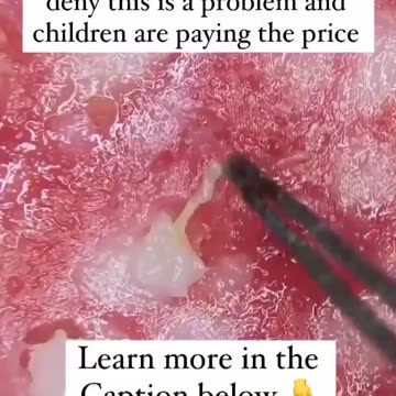 Pepperoni pizza anyone??? 🤢🤮