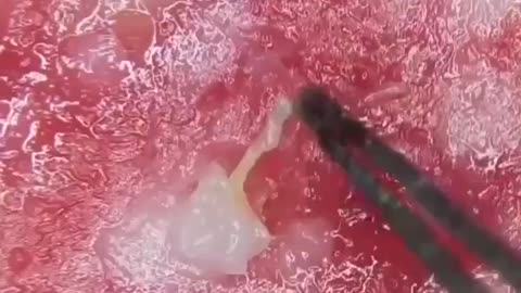 Pepperoni pizza anyone??? 🤢🤮