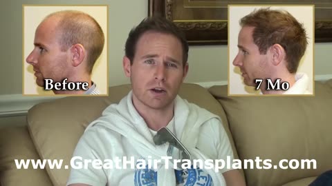 Dr. Brett Bolton Life-Changing Hair Restoration Transformation
