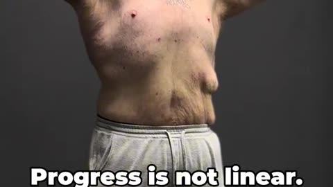 An amazing weight loss