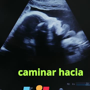 😊 60 ¡TÚ YA FUISTE BENDECIDO DESDE ANTES! Jeremías 1:5 😊