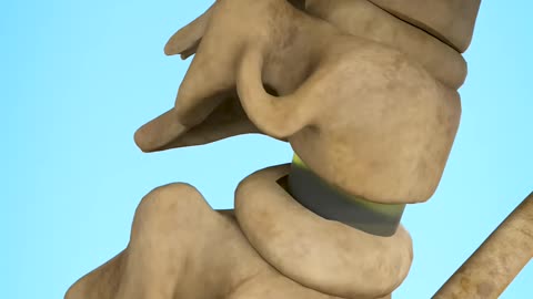 How Cracking Your Neck Can Kill You