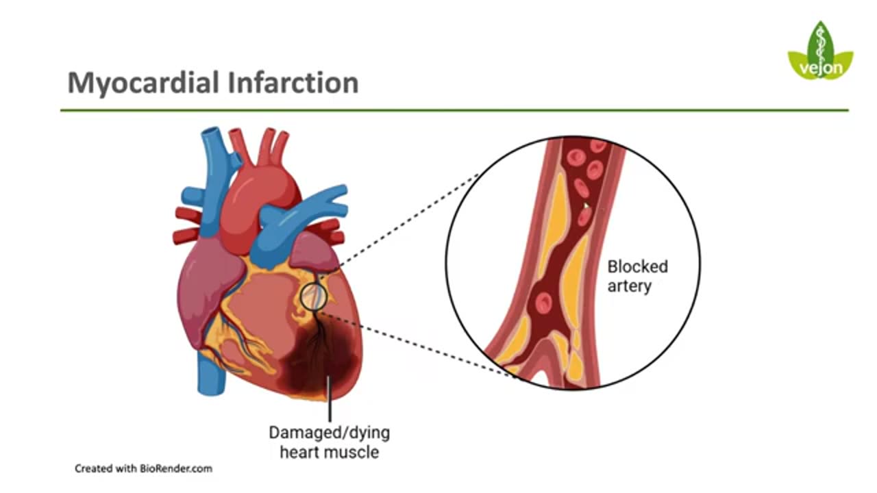NEW HEART CONDITIONS EXPOSED