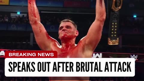 Gunther Speaks Out After Brutal Attack