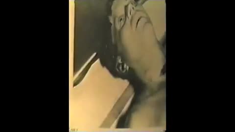 Kennedy Autopsy Photographs Research Video (1981 Mark A Crouch)